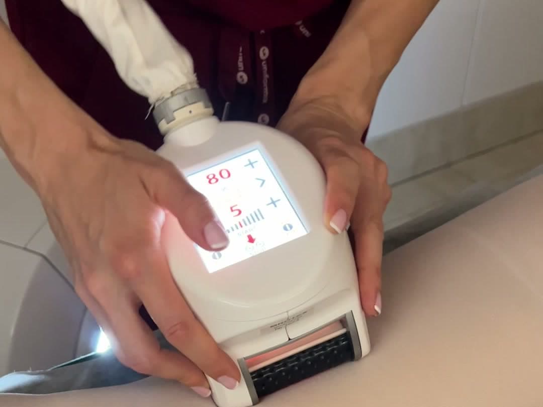 Głowica Roboderm® z bliska